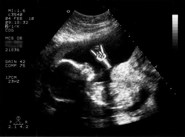 Maternidad romántica